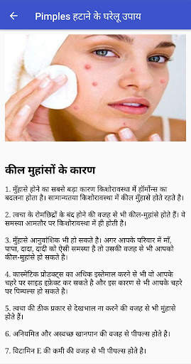 Pimples हटाने के घरेलू उपाय screenshot 1