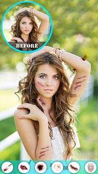Injury Photo Editor скриншот 3
