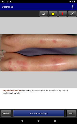 Pediatric Dermatology DDx Deck, 2nd Edition screenshot 14