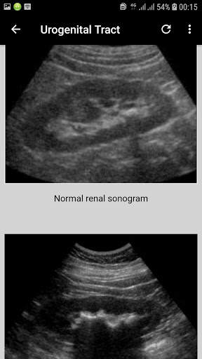 x-ray interpretation guide screenshot 5