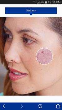 SkinBetter 3 تصوير الشاشة