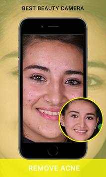 Best Sweet Cam Beauty Selfie Photo Filter Editor screenshot 8