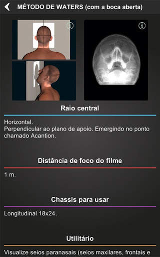 RX - Radiologia Posicionamento screenshot 9