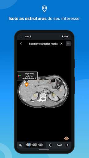 e-Anatomy screenshot 4