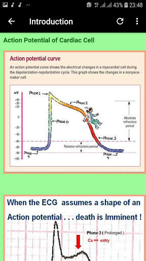Clinical ECG Interpretation - GUIDE APP screenshot 3