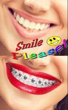Braces Teeth Photo Maker screenshot 1