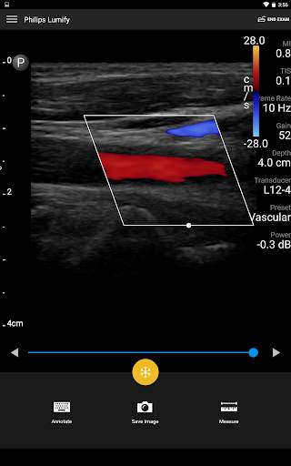 Philips Lumify Ultrasound App screenshot 3