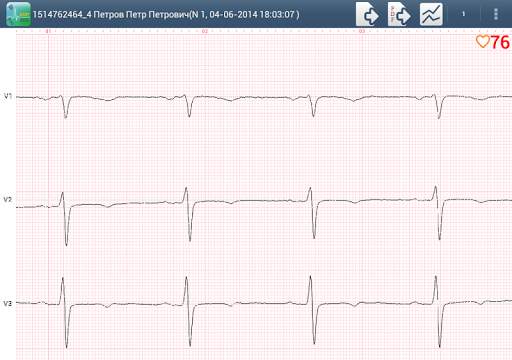 Easy ECG Mobile PRO screenshot 9