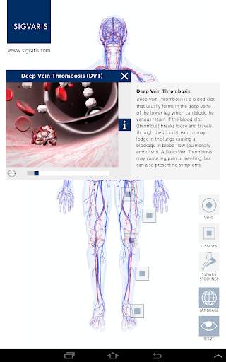 SIGVARIS Phlebo-App for tablet screenshot 3
