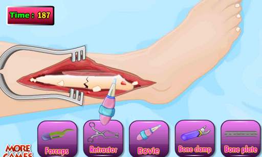Doktor Tom Beinoperation Spiel screenshot 2