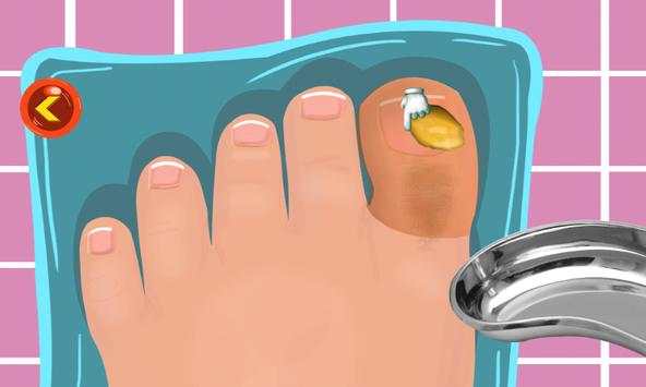 Toe Surgery Doctor Game screenshot 5