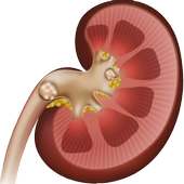 Clean your Kidneys