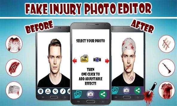 Fake Injuries Photo Editor 2019-Injury Marks Maker screenshot 7