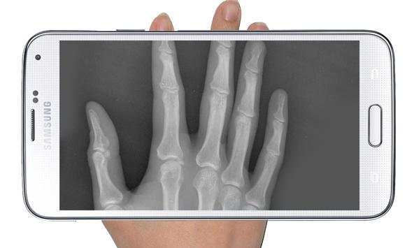 X Ray Scanner Prank screenshot 1
