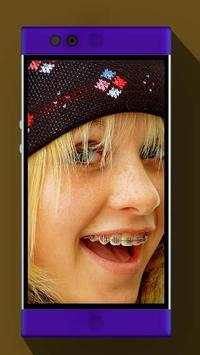 Real Braces Booth HD Studio screenshot 4