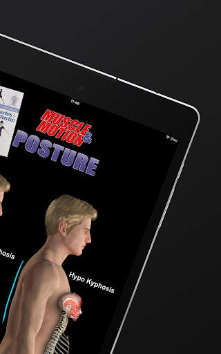 Posture by Muscle & Motion screenshot 10