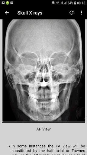 x-ray interpretation guide screenshot 7