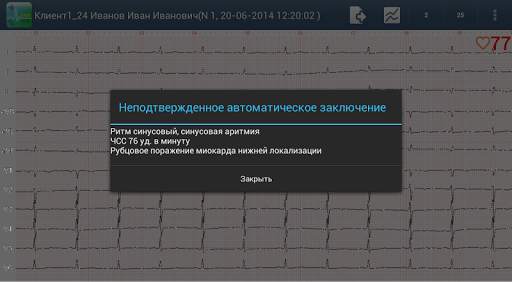 Easy ECG Mobile PRO screenshot 4