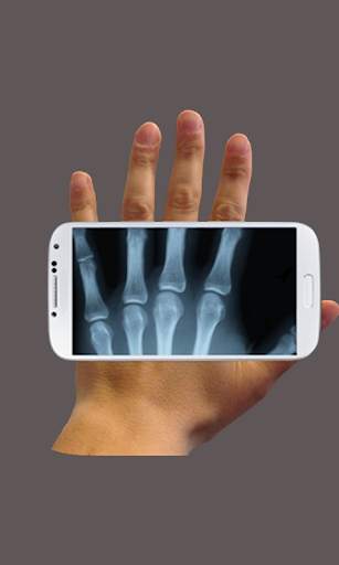 X-ray Cam Prank screenshot 1