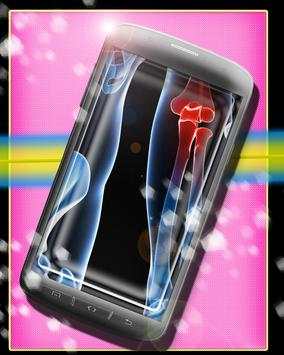 My X-ray APP screenshot 2
