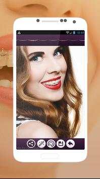 Braces Teeth Photo Editor screenshot 1