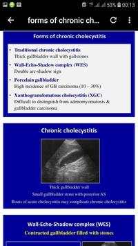 abdominal ultrasound of gallbladder скриншот 24