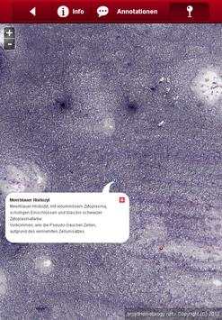 Smart Hematology Lite screenshot 3