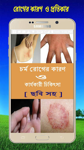 চর্ম রোগের কারণ  ও  কার্যকারী চিকিৎসা [ ছবি সহ ] screenshot 1