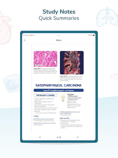 Osmosis Med Videos & Notes screenshot 11