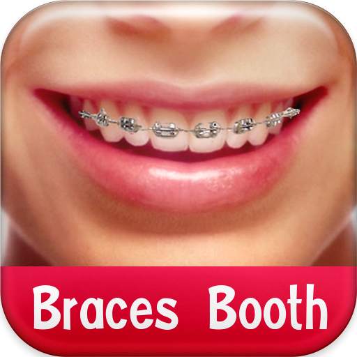 Braces Booth 1.8
