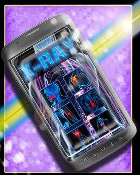 My X-ray APP screenshot 1