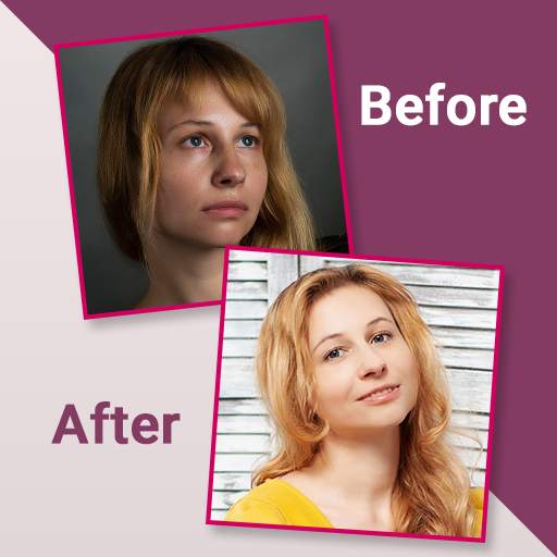 Before After Photo Collage - Compare Old Photos 3.0