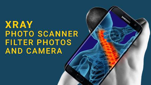 Body scanner x ray mobile App screenshot 4