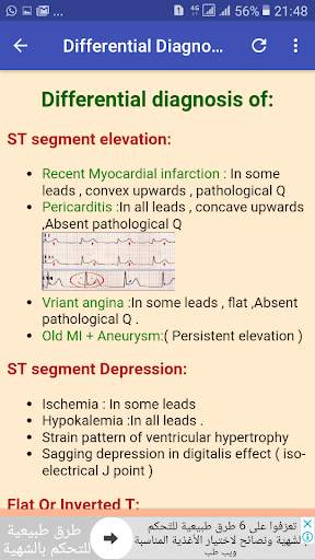 ECG Interpretation Made Easy скриншот 5
