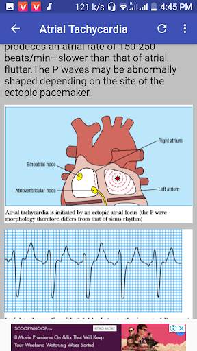 Clinical ECG Guide. screenshot 1