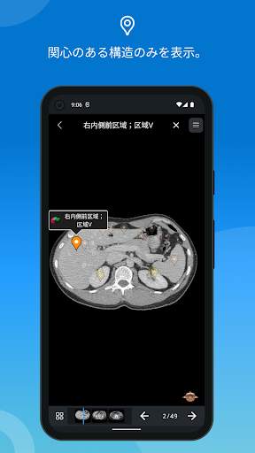 e-Anatomy screenshot 4