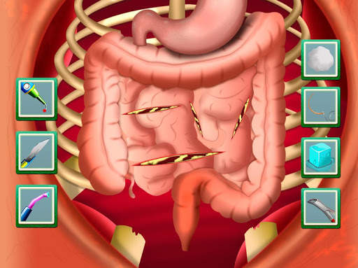 HOSPITAL SURGERY GAME – OPERATE NOW SIMULATOR screenshot 5