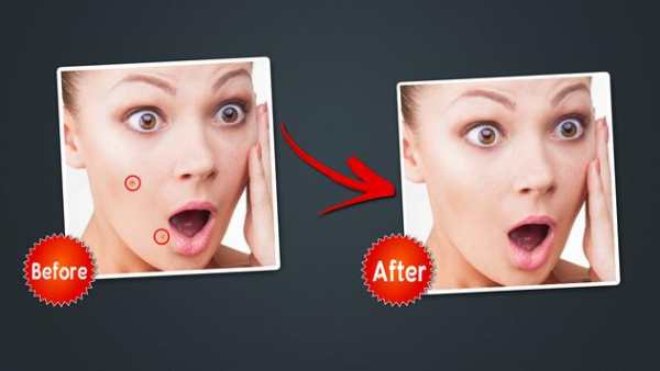 Object Remover -Erase Object -Face Blemish Remover screenshot 9