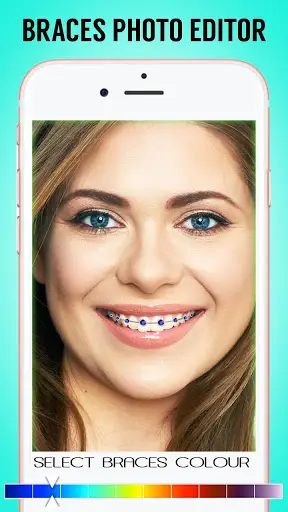 Braces 2.0 screenshot 3