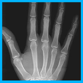 Xray icon