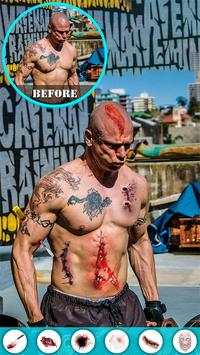 Injury Photo Editor скриншот 11