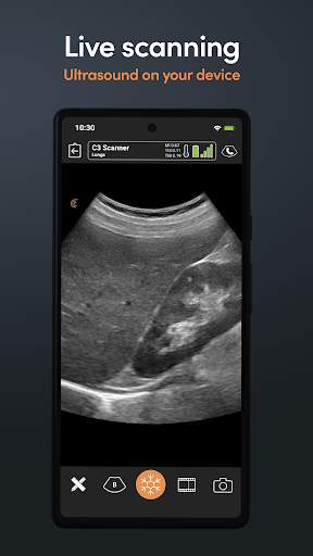 Clarius Ultrasound скриншот 2