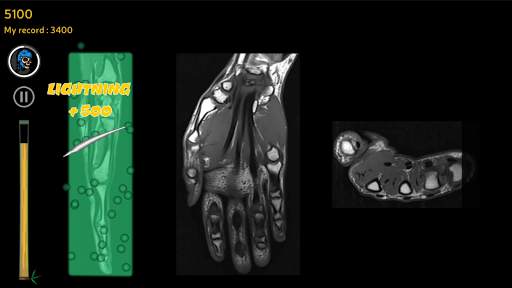 Anatomy Ninja Upper Limb screenshot 3