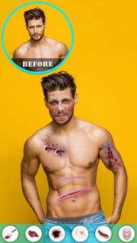 Injury Photo Editor скриншот 5