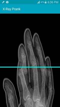 X Ray Scanner Prank screenshot 3