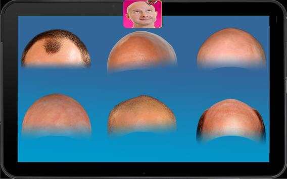 Make Me Bald Head screenshot 6