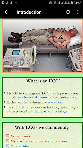 Clinical ECG Interpretation - GUIDE APP screenshot 4
