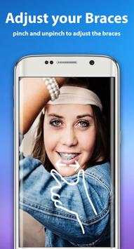 Braces 2018 screenshot 1