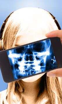 Xray Scanner screenshot 2