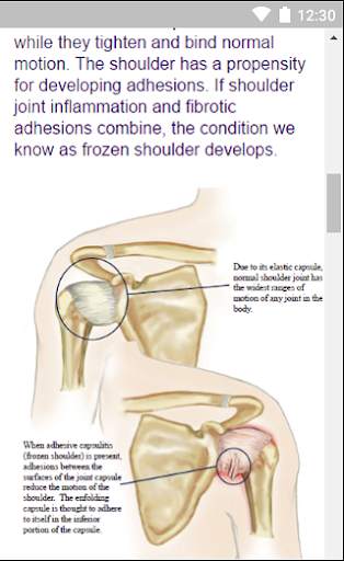 Frozen Shoulder Protocols screenshot 2